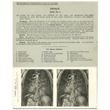 116. Roots of the Lungs, OEsophagus, Stomach, Pancreas, &c., from behind, in situ. The Edinburgh Stereoscopic Atlas of Anatomy. Thorax. Back - N°4.