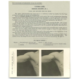 118. Shoulder from the front. The Edinburgh Stereoscopic Atlas of Anatomy. Upper limb. Surface anatomy - N°1. 