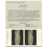 205. Front of Thigh. The Edinburgh Stereoscopic Atlas of Anatomy. Lower limb. Surface anatomy - N°1. 