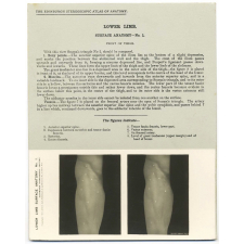 205. Front of Thigh. The Edinburgh Stereoscopic Atlas of Anatomy. Lower limb. Surface anatomy - N°1. 
