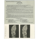 239. Second layer of Muscles. The Edinburgh Stereoscopic Atlas of Anatomy. Lower limb. Sole of foot - N°3.