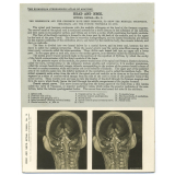 195. Brain Stem and Cranial Nerves in situ. The Edinburgh Stereoscopic Atlas of Anatomy. Head and Neck. Spinal canal - N°3.