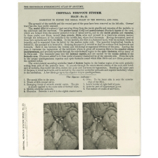 175. The Mesial Fillet in the Medulla and Pons. The Edinburgh Stereoscopic Atlas of Anatomy. Central nervous system. Brain - N°23.
