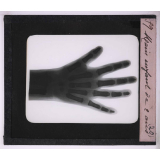 La Radiographie appliquée aux Sciences médicales. Main, enfant de 2 ans.