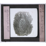 Le Microscope. Ce qu'il permet de voir dans le corps humain. Bacille d'Eberth.