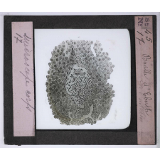 Le Microscope. Ce qu'il permet de voir dans le corps humain. Bacille d'Eberth.