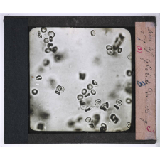 Le Microscope. Ce qu'il permet de voir dans le corps humain. Globule du sang.