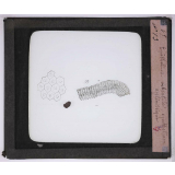 Microbes bacilles. Épithélium vibratile - Épithélium cylindrique.