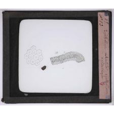 Microbes bacilles. Épithélium vibratile - Épithélium cylindrique.