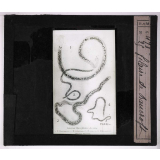 Les Animaux parasites de l'homme. Filaire de Bancroft.