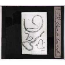 Les Animaux parasites de l'homme. Filaire de Bancroft.