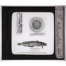 Les Animaux parasites de l'homme. Bothriocephalus latus.