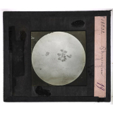 La Tuberculose. Phagocytose.