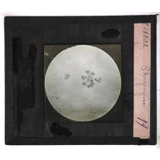La Tuberculose. Phagocytose.
