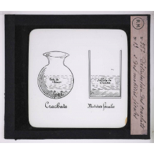 Prophylaxie des maladies contagieuses. 1ère série. Transmises par les déjections, les matières fécales, l'eau souillée; les sécrétions respiratoire. Désinfection des crachats et des matières fécales.