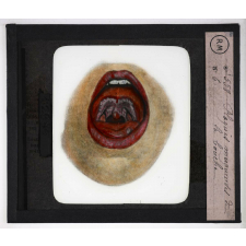 Prophylaxie des maladies contagieuses. 2e série. Transmises par les produits cutanés, le pus, les sécrétions oculaires, les parasites. Plaques muqueuses de la bouche.