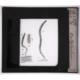 Les Animaux parasites de l'homme. Ankylostome.