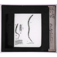 Les Animaux parasites de l'homme. Ankylostome.