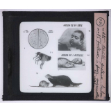 Maladies transmises à l'homme par les animaux. 1° Bacille pesteux - 2° bubon pesteux - 3° puce - 4° marmotte et rat.