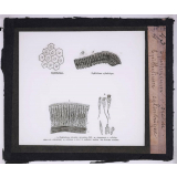 Microbes bacilles. Épithélium vibratile - Épithélium cylindrique.