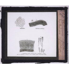 Microbes bacilles. Épithélium vibratile - Épithélium cylindrique.