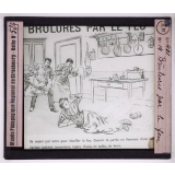 Soins d'urgence aux blessés et malades. Brûlures par le feu.