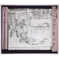 Soins d'urgence aux blessés et malades. Brûlures par le feu.