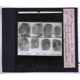 L'Anthropométrie appliquée à l'identification judiciaire - système A. Bertillon. Empreintes des sillons cutanés de doigts.