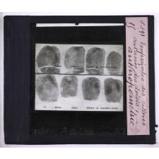 L'Anthropométrie appliquée à l'identification judiciaire - système A. Bertillon. Empreintes des sillons cutanés de doigts.