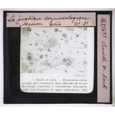Les Maladies du cuir chevelu. Bacille de Koch.