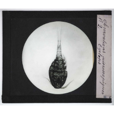 Quelques exemples d'observations microscopiques. Cyclops.