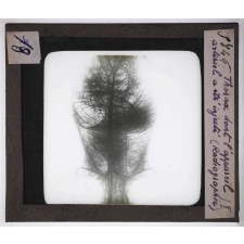 Digestion et circulation. Thorax dont l'appareil artériel a été injecté (Radiographie).