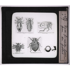 Les Animaux parasites de l'homme. Puce punaise pou, pou du pubis.