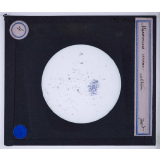 Bactéries. Micrococcus ureae culture.