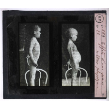 Les Dessanglés du ventre. Effets d'une saine culture physique.