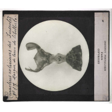 Caractères extérieurs des insectes. Masque de larve de libellule.