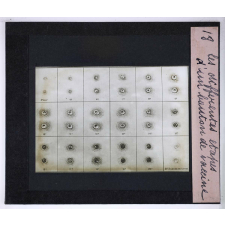 Les Etapes de la préservation de la variole. Les différentes étapes d'un bouton de vaccine.