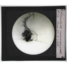 Quelques exemples d'observations microscopiques. Larve zoé de crabe.