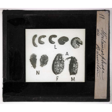 Métamorphoses des insectes. Métamorphose du Hanneton.