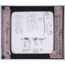 Maladies transmises à l'homme par les animaux. 1° Taenia - 2° Bothriocéphalus latus - 3° Ascaris - 4° Trichocéphale - 5° Ankylostome et œufs - 6 Oxyures et œufs.