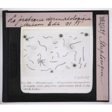Les Maladies du cuir chevelu. Streptocoque.