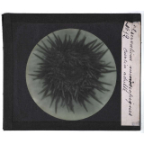 Quelques exemples d'observations microscopiques. Oursin adulte.
