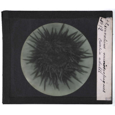 Quelques exemples d'observations microscopiques. Oursin adulte.