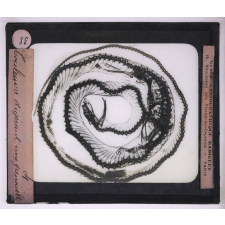 La Radiographie appliquée aux Sciences médicales. Couleuvre digérant une grenouille.