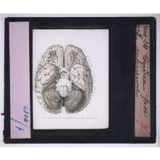 Système nerveux. Cerveau. Face inférieure.