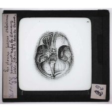 Digestion et circulation. Les douze paires crâniennes pénétrant sans les canaux ostèo-fibreux de la base du crâne.