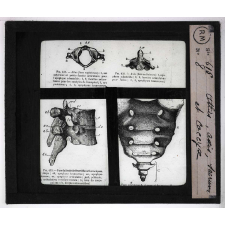 Squelette. Atlas, axis, sacrum et coccyx.