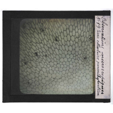Quelques exemples d'observations microscopiques. Tissu cellulaire parenchymateux.