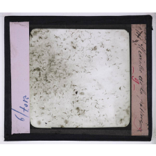 Respiration. Microbe de la phtisie.