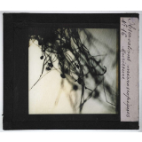 Quelques exemples d'observations microscopiques. Moisissure.